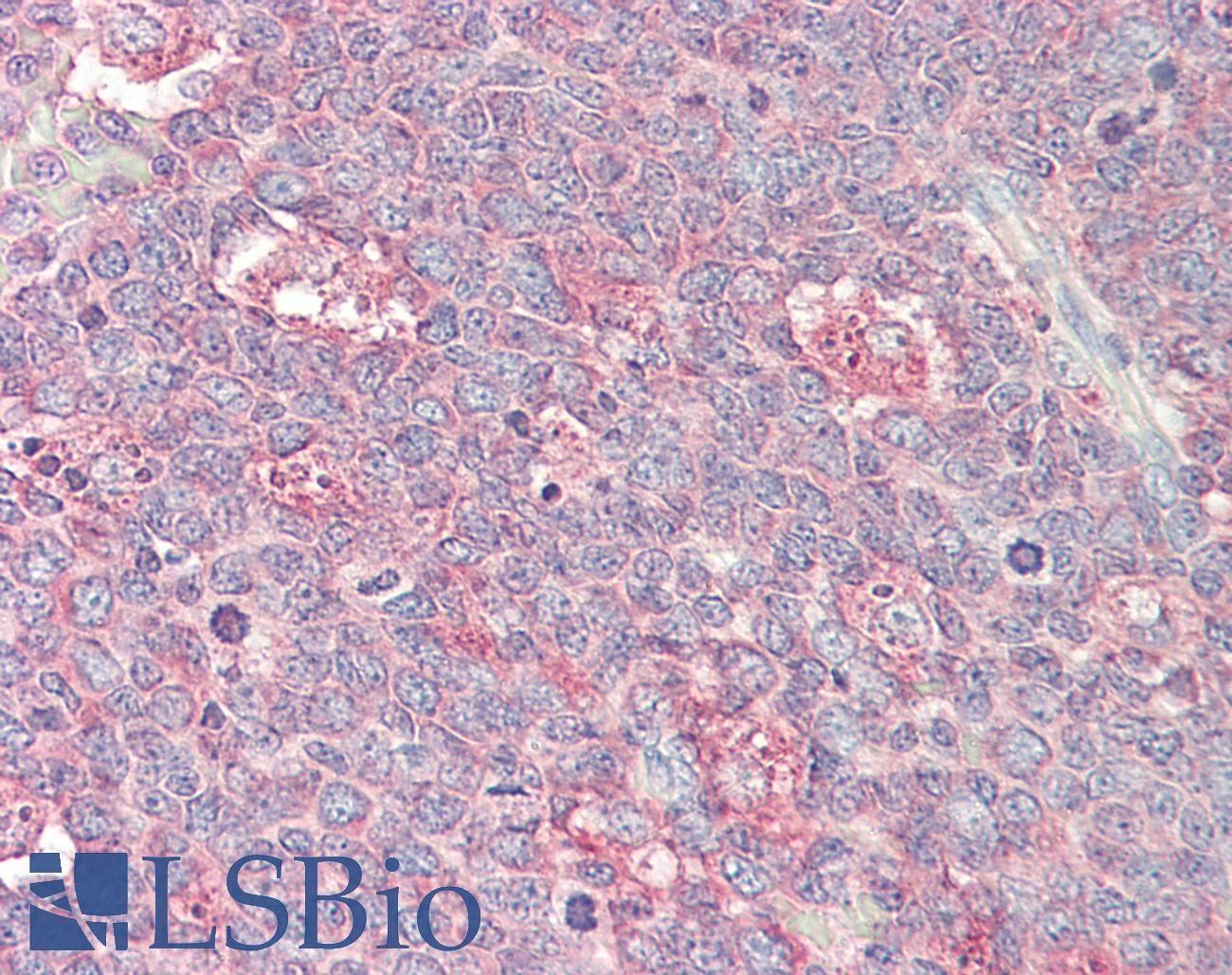 p21-ARC / ARPC3 Antibody - Anti-p21-ARC / ARPC3 antibody IHC staining of human tonsil. Immunohistochemistry of formalin-fixed, paraffin-embedded tissue after heat-induced antigen retrieval. Antibody concentration 20 ug/ml. This image was taken for the unconjugated form of this product. Other forms have not been tested.