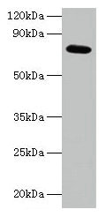 p21-ARC / ARPC3 Antibody - Western blot Actin-related protein 2/3 complex subunit 3 antibody at 2µg/ml + 293T whole cell lysate Secondary Goat polyclonal to rabbit IgG at 1/15000 dilution Predicted band size: 20 kDa Observed band size: 75 kDa