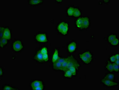 p21-ARC / ARPC3 Antibody - Immunofluorescent analysis of PC-3 cells using ARPC3 Antibody at dilution of 1:100 and Alexa Fluor 488-congugated AffiniPure Goat Anti-Rabbit IgG(H+L)