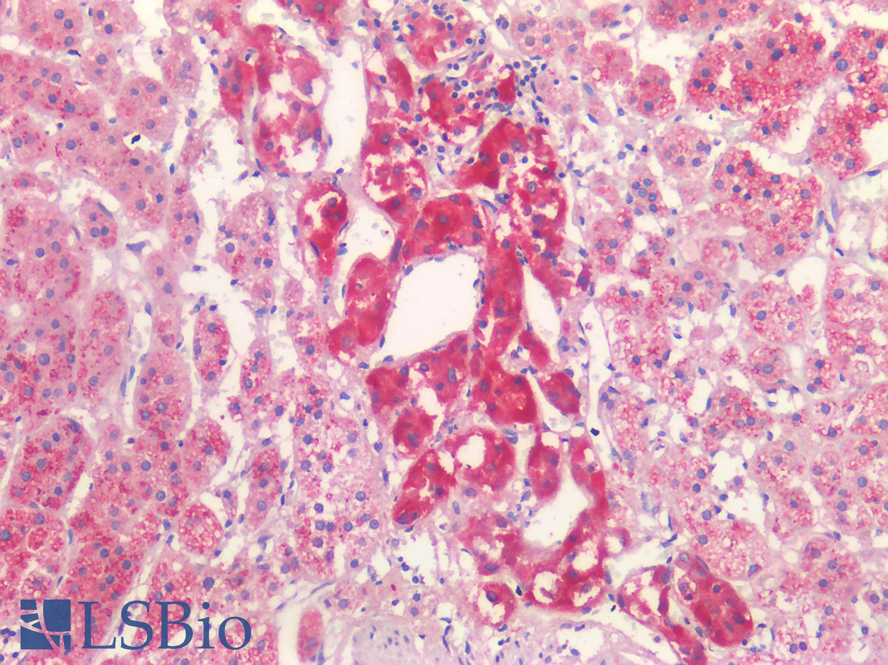 P2RX3 / P2X3 Antibody - Human Adrenal: Formalin-Fixed, Paraffin-Embedded (FFPE)