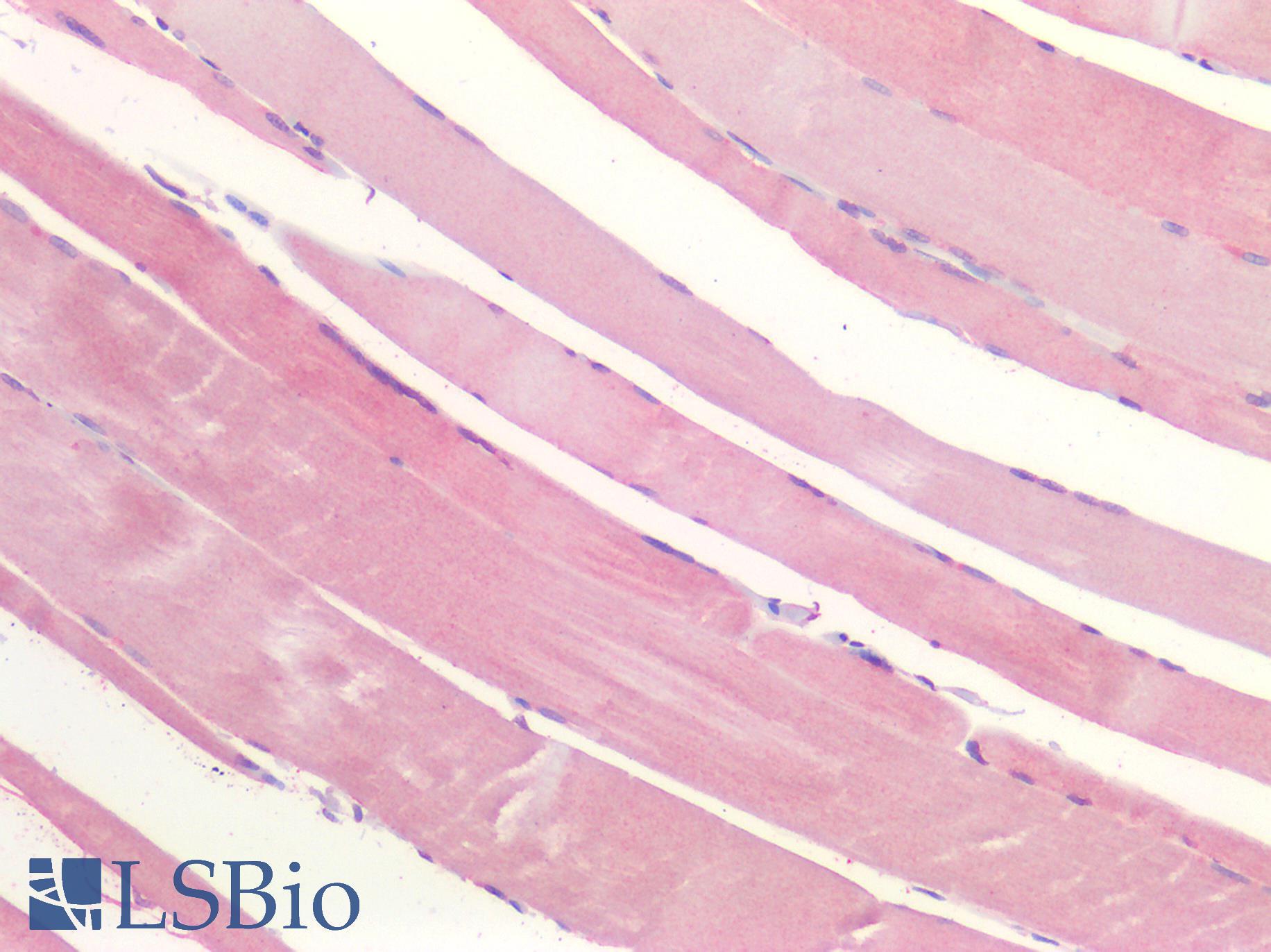 P2RX3 / P2X3 Antibody - Human Skeletal Muscle: Formalin-Fixed, Paraffin-Embedded (FFPE)