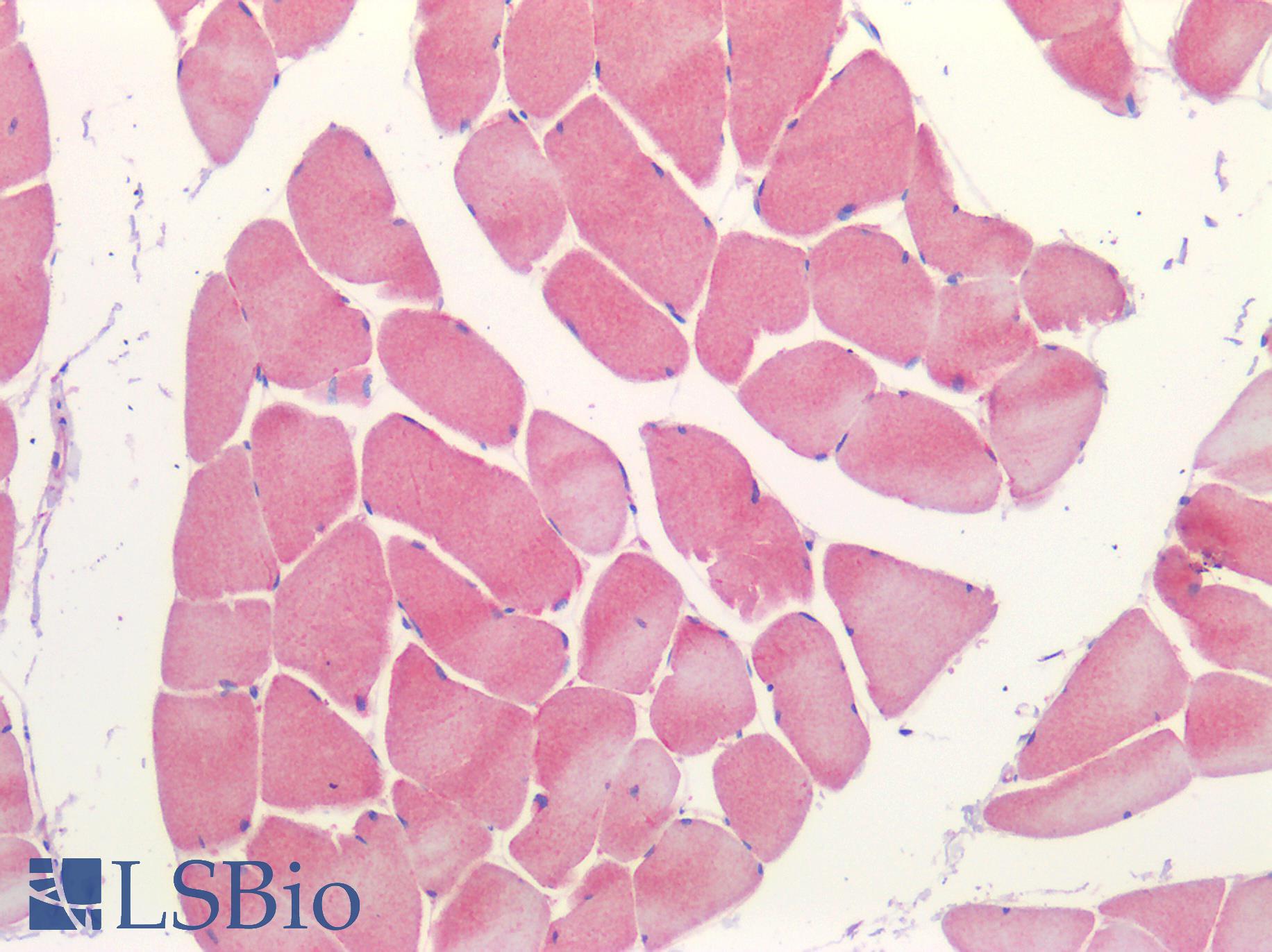 P2RX3 / P2X3 Antibody - Human Skeletal Muscle: Formalin-Fixed, Paraffin-Embedded (FFPE)