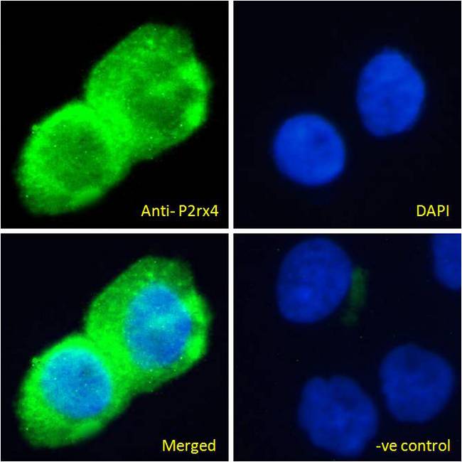 P2RX4 / P2X4 Antibody - P2RX4 / P2X4 antibody immunofluorescence analysis of paraformaldehyde fixed A431 cells, permeabilized with 0.15% Triton. Primary incubation 1hr (10ug/ml) followed by Alexa Fluor 488 secondary antibody (4ug/ml), showing cytoplasmic staining. The nuclear stain is DAPI (blue). Negative control: Unimmunized goat IgG (10ug/ml) followed by Alexa Fluor 488 secondary antibody (2ug/ml).