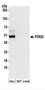 P2RX5 / P2X5 Antibody - Detection of Human P2RX5 by Western Blot. Samples: Whole cell lysate (50 ug) prepared using NETN buffer from HeLa, 293T, and Jurkat cells. Antibodies: Affinity purified rabbit anti-P2RX5 antibody used for WB at 0.1 ug/ml. Detection: Chemiluminescence with an exposure time of 30 seconds.