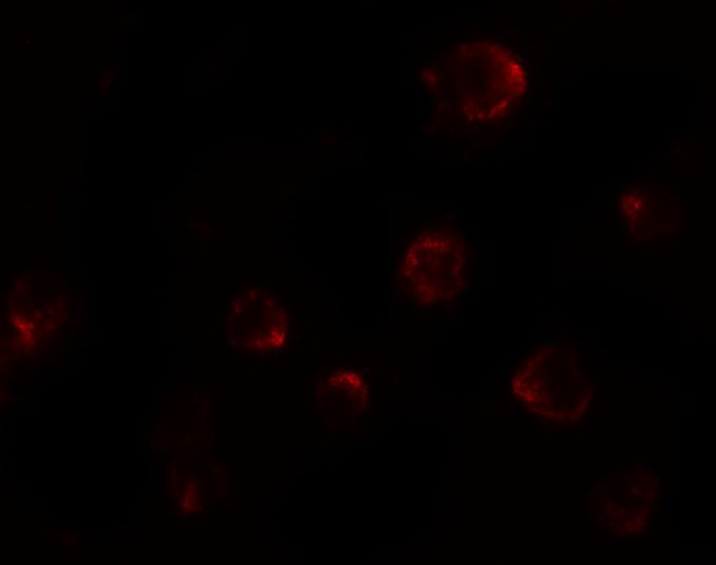 P2RX7 / P2X7 Antibody - Immunofluorescence of P2RX7 in 3T3 cells with P2RX7 antibody at 20 ug/mL.