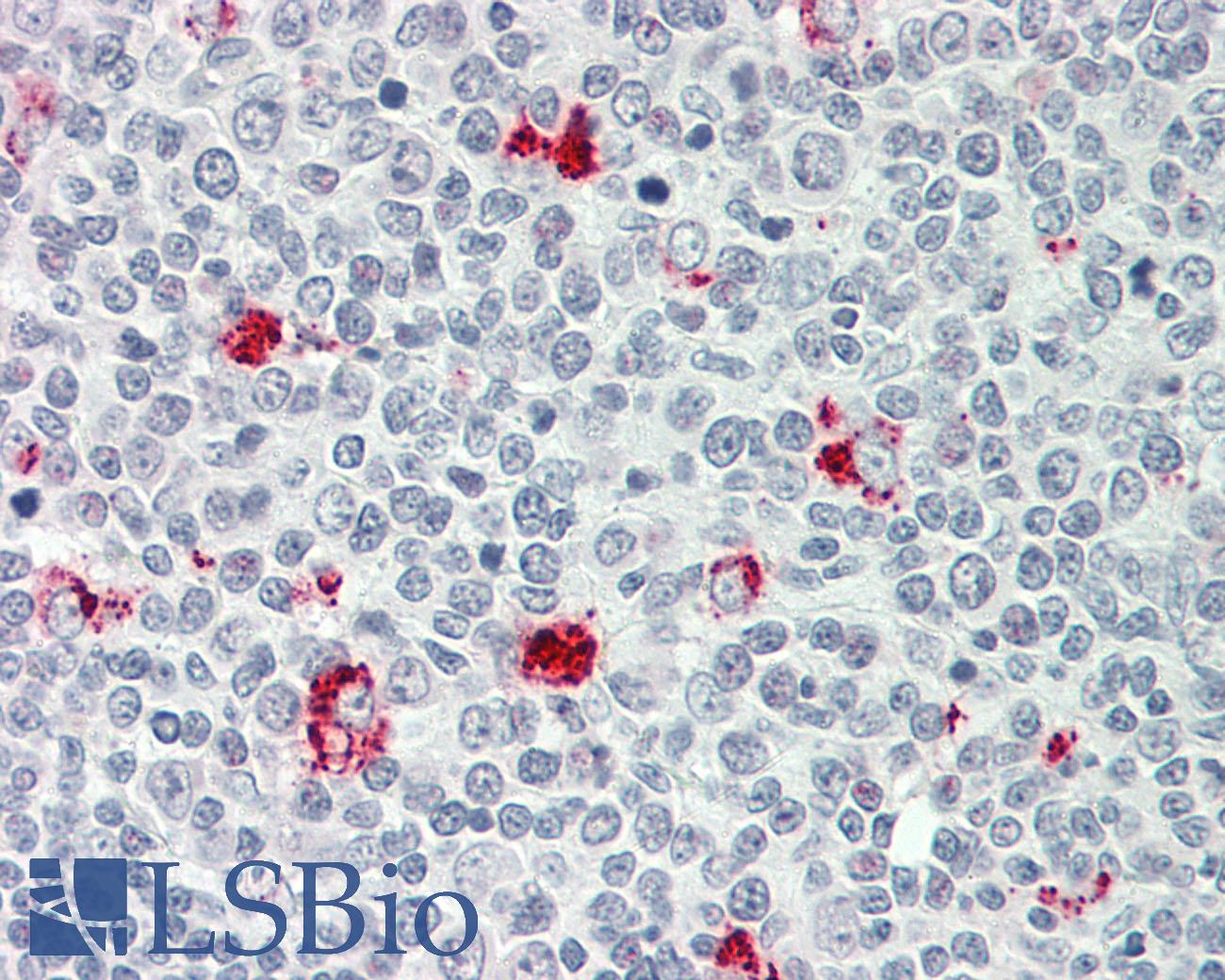 P2RY11 / P2Y11 Antibody - Human Tonsil: Formalin-Fixed, Paraffin-Embedded (FFPE)