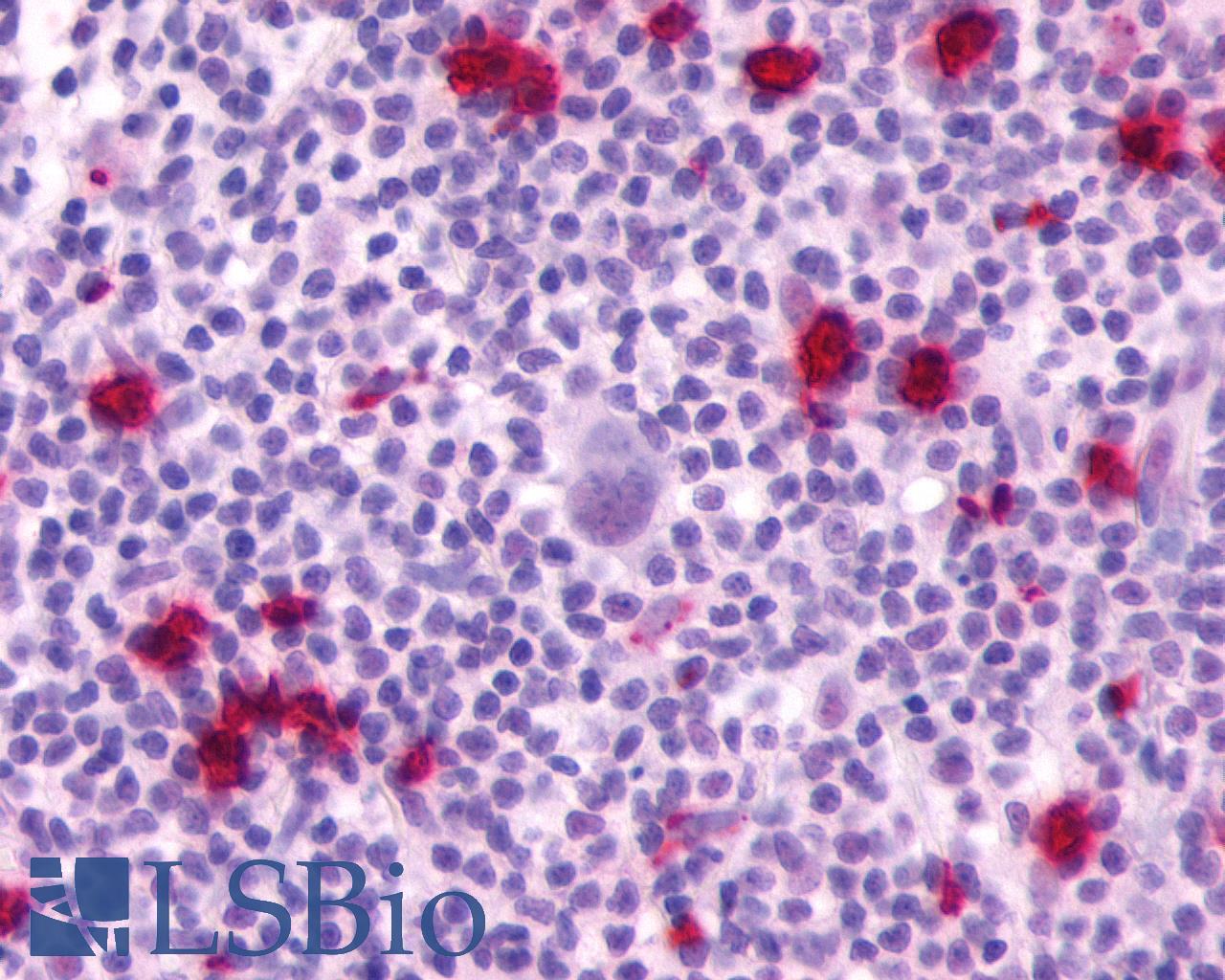 P2RY4 / P2Y4 Antibody - Anti-P2RY4 / P2Y4 antibody IHC of human Lymph Node, Hodgkins Lymphoma. Immunohistochemistry of formalin-fixed, paraffin-embedded tissue after heat-induced antigen retrieval.