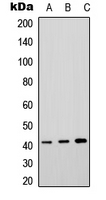 P2RY4 / P2Y4 Antibody - Western blot analysis of P2Y4 expression in HeLa (A); rat brain (B); rat lung (C) whole cell lysates.