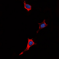P2RY4 / P2Y4 Antibody - Immunofluorescent analysis of P2Y4 staining in HeLa cells. Formalin-fixed cells were permeabilized with 0.1% Triton X-100 in TBS for 5-10 minutes and blocked with 3% BSA-PBS for 30 minutes at room temperature. Cells were probed with the primary antibody in 3% BSA-PBS and incubated overnight at 4 deg C in a humidified chamber. Cells were washed with PBST and incubated with a DyLight 594-conjugated secondary antibody (red) in PBS at room temperature in the dark. DAPI was used to stain the cell nuclei (blue).