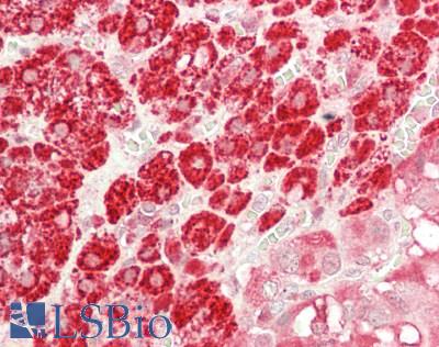 P450SCC / CYP11A1 Antibody - Human Adrenal: Formalin-Fixed, Paraffin-Embedded (FFPE)
