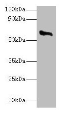 P450SCC / CYP11A1 Antibody - Western blot All lanes: Cholesterol side-chain cleavage enzyme, mitochondrial antibody at 2µg/ml + Rat adrenal gland Secondary Goat polyclonal to rabbit IgG at 1/10000 dilution Predicted band size: 61, 43 kDa Observed band size: 61 kDa