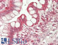 P4HA1 Antibody - Human Small Intestine: Formalin-Fixed, Paraffin-Embedded (FFPE)
