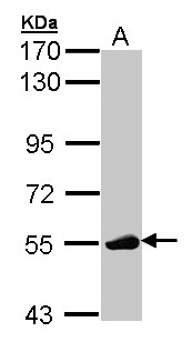 p56lck / LCK Antibody - Sample (30 ug of whole cell lysate). A: Molt-4. 7.5% SDS PAGE. LCK antibody diluted at 1:1000. 