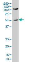 p66 / SHC Antibody - SHC1 monoclonal antibody clone 3F4 Western blot of SHC1 expression in A-431.