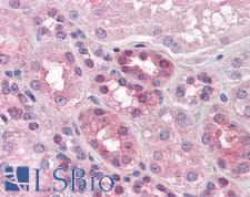 PACE4 / PCSK6 Antibody - Anti-PACE4 antibody IHC of human kidney. Immunohistochemistry of formalin-fixed, paraffin-embedded tissue after heat-induced antigen retrieval. Antibody concentration 5 ug/ml.