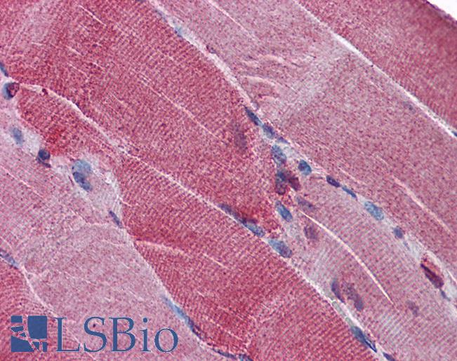 PACE4 / PCSK6 Antibody - Anti-PACE4 antibody IHC of human skeletal muscle. Immunohistochemistry of formalin-fixed, paraffin-embedded tissue after heat-induced antigen retrieval. Antibody concentration 3.75 ug/ml.