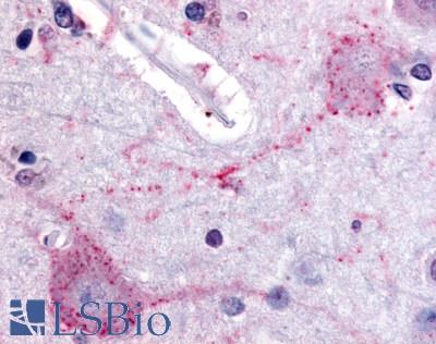 PACE4 / PCSK6 Antibody - Anti-PACE4 antibody IHC of human brain, cortex. Immunohistochemistry of formalin-fixed, paraffin-embedded tissue after heat-induced antigen retrieval.