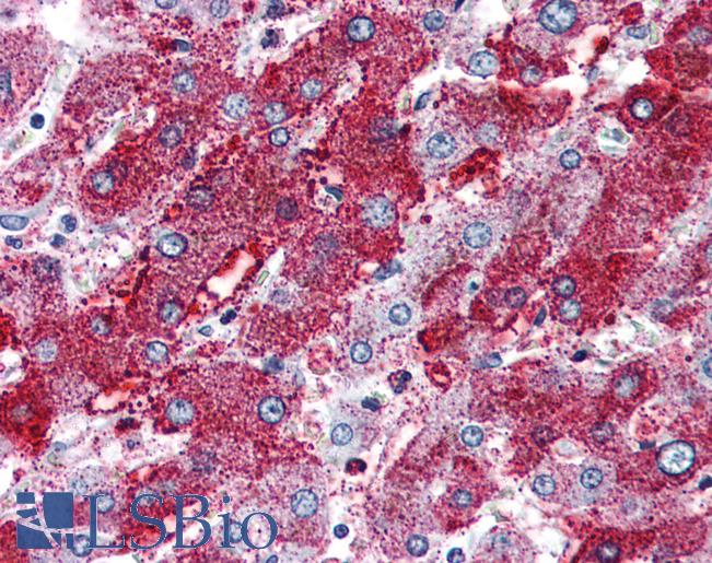 PACE4 / PCSK6 Antibody - Anti-PACE4 antibody IHC of human liver. Immunohistochemistry of formalin-fixed, paraffin-embedded tissue after heat-induced antigen retrieval.
