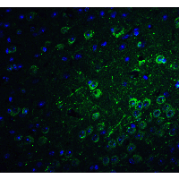PACS1 Antibody - Immunofluorescence of PACS1 in mouse brain tissue with PACS1 antibody at 20 µg/ml.