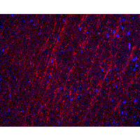 PACS2 Antibody - Immunofluorescence of PACS2 in mouse brain tissue with PACS2 antibody at 20 µg/ml.