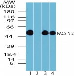 PACSIN2 Antibody - Western blot of PACSIN2 in human brain lysate in the 1) absence and 2) presence of immunizing peptide, 3) mouse brain lysate and 4) rat brain lysate using antibody at 0.05 ug/ml.