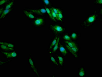PAD2 / PADI2 Antibody - Immunofluorescence staining of Hela cells with PADI2 Antibody at 1:100, counter-stained with DAPI. The cells were fixed in 4% formaldehyde, permeabilized using 0.2% Triton X-100 and blocked in 10% normal Goat Serum. The cells were then incubated with the antibody overnight at 4°C. The secondary antibody was Alexa Fluor 488-congugated AffiniPure Goat Anti-Rabbit IgG(H+L).