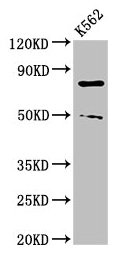 PAD2 / PADI2 Antibody - Western Blot Positive WB detected in: K562 whole cell lysate All lanes: PADI2 antibody at 3µg/ml Secondary Goat polyclonal to rabbit IgG at 1/50000 dilution Predicted band size: 76, 50 kDa Observed band size: 76 kDa