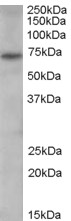 PADI4 / PAD4 Antibody - Antibody (0.3 ug/ml) staining of human spleen lysate (35 ug protein in RIPA buffer). Primary incubation was 1 hour. Detected by chemiluminescence.