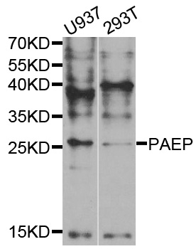 PAEP / Glycodelin / GdF Antibody - Western blot analysis of extracts of various cell lines.