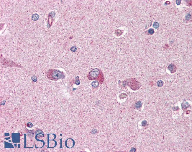 PAFAH1B1 / LIS1 Antibody - Anti-PAFAH1B1 / LIS1 antibody IHC of human brain, cortex. Immunohistochemistry of formalin-fixed, paraffin-embedded tissue after heat-induced antigen retrieval. Antibody concentration 75 ug/ml.