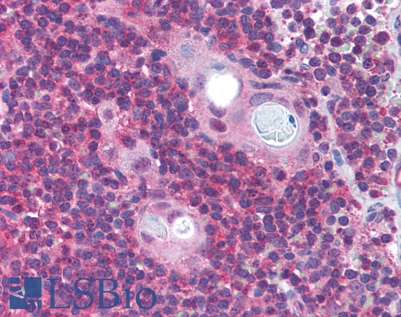 PAFAH1B1 / LIS1 Antibody - Anti-PAFAH1B1 / LIS1 antibody IHC of human thymus. Immunohistochemistry of formalin-fixed, paraffin-embedded tissue after heat-induced antigen retrieval. Antibody concentration 5 ug/ml.