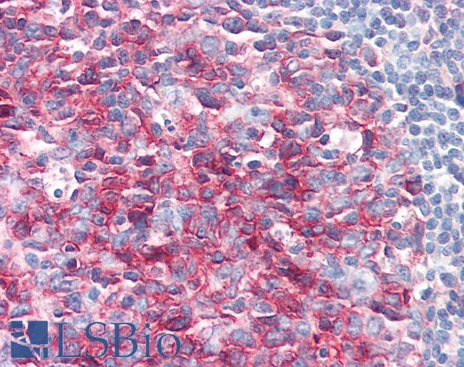PAG1 Antibody - Anti-PAG1 / PAG antibody IHC of human tonsil. Immunohistochemistry of formalin-fixed, paraffin-embedded tissue after heat-induced antigen retrieval. Antibody concentration 10 ug/ml.