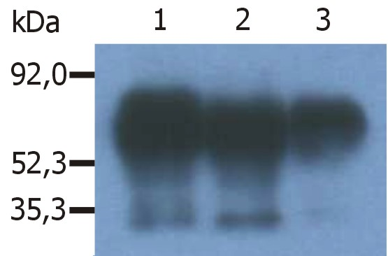 PAG1 Antibody - Immunoprecipitation of human PAG/Cbp from the lysate of RAJI human Burkitt lymphoma cell line.  Western blot was immunostained with anti-human PAG (MEM-255).  Note: PAG/Cbp is a 46 kDa adaptor protein, which however migrates on SDS PAGE gels anomalously as an 80 kDa molecule.  Lane 1,2: immunoprecipitation with anti-PAG (PAG-C1)  Lane 3: immunoprecipitation with anti-PAG (polyclonal antibody)