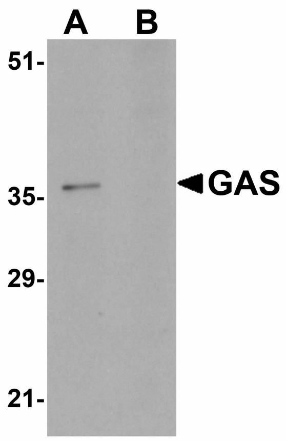 PAGR1 / C16orf53 Antibody - Western blot of GAS in EL4 cell lysate in (A) the absence and (B) the presence of blocking peptide with GAS antibody at 1 ug/ml.