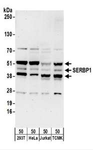 PAI-RBP1 / SERBP1 Antibody - Detection of Human and Mouse SERBP1 by Western Blot. Samples: Whole cell lysate (50 ug) from 293T, HeLa, Jurkat, and mouse TCMK-1 cells. Antibodies: Affinity purified rabbit anti-SERBP1 antibody used for WB at 0.1 ug/ml. Detection: Chemiluminescence with an exposure time of 3 minutes.