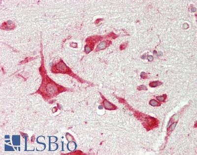 PAI-RBP1 / SERBP1 Antibody - Human Brain, Cortex: Formalin-Fixed, Paraffin-Embedded (FFPE)