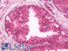 PAI-RBP1 / SERBP1 Antibody - Anti-SERPINE1 / PAI-1 antibody IHC staining of human prostate. Immunohistochemistry of formalin-fixed, paraffin-embedded tissue after heat-induced antigen retrieval.