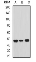 PAICS / ADE2 Antibody - Western blot analysis of ADE2 expression in Jurkat (A); Raji (B); HeLa (C) whole cell lysates.