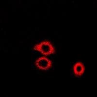 PAICS / ADE2 Antibody - Immunofluorescent analysis of ADE2 staining in U2OS cells. Formalin-fixed cells were permeabilized with 0.1% Triton X-100 in TBS for 5-10 minutes and blocked with 3% BSA-PBS for 30 minutes at room temperature. Cells were probed with the primary antibody in 3% BSA-PBS and incubated overnight at 4 deg C in a humidified chamber. Cells were washed with PBST and incubated with a DyLight 594-conjugated secondary antibody (red) in PBS at room temperature in the dark.