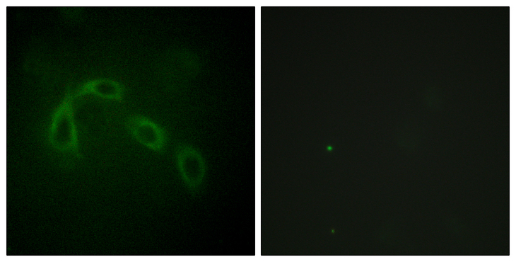PAK1 Antibody - Immunofluorescence analysis of HeLa cells, using PAK1/2 Antibody. The picture on the right is blocked with the synthesized peptide.