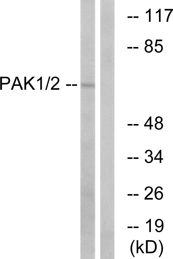 PAK1 Antibody - Western blot analysis of lysates from K562 cells, using PAK1/2 Antibody. The lane on the right is blocked with the synthesized peptide.