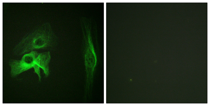 PAK1 Antibody - Immunofluorescence analysis of HeLa cells, using PAK1 Antibody. The picture on the right is blocked with the synthesized peptide.