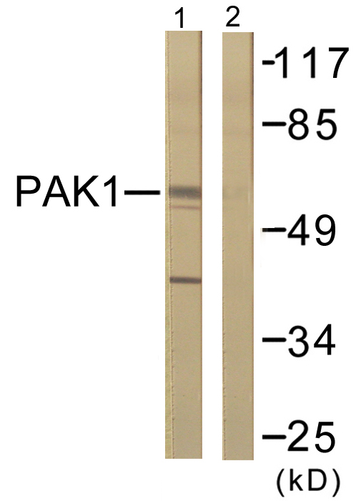 PAK1 Antibody - Western blot analysis of lysates from 293 cells, treated with Etoposide 25uM 60', using PAK1 Antibody. The lane on the right is blocked with the synthesized peptide.