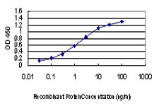 PAK1 Antibody - Detection limit for recombinant GST tagged PAK1 is approximately 0.03 ng/ml as a capture antibody.