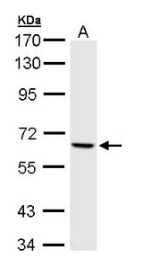 PAK1 Antibody - Sample (30 ug of whole cell lysate). A: A431. 7.5% SDS PAGE. PAK1 antibody diluted at 1:1000