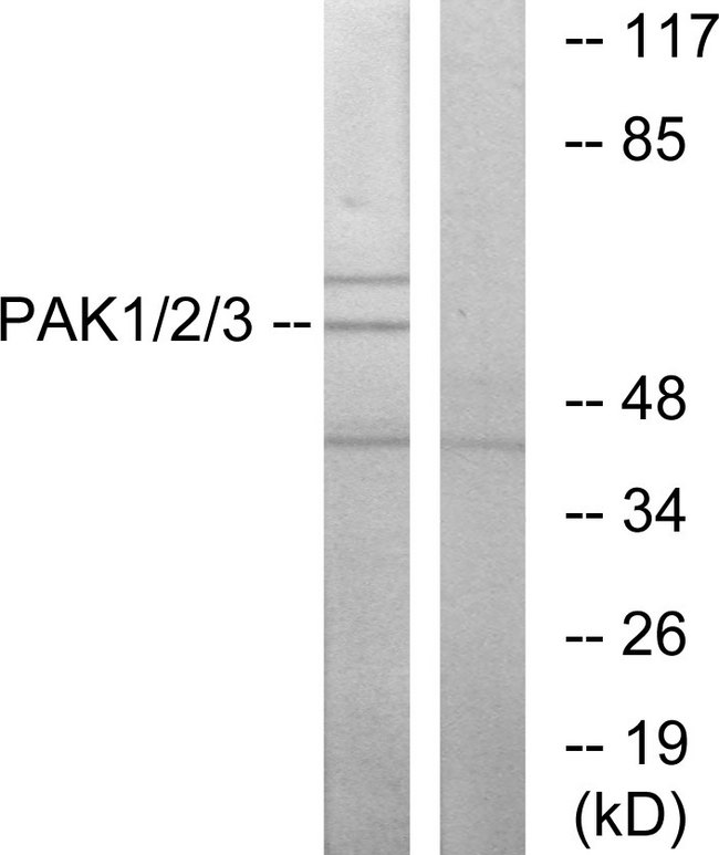 PAK1 + PAK2 + PAK3 Antibody - Western blot analysis of lysates from NIH/3T3 cells, using PAK1/2/3 Antibody. The lane on the right is blocked with the synthesized peptide.