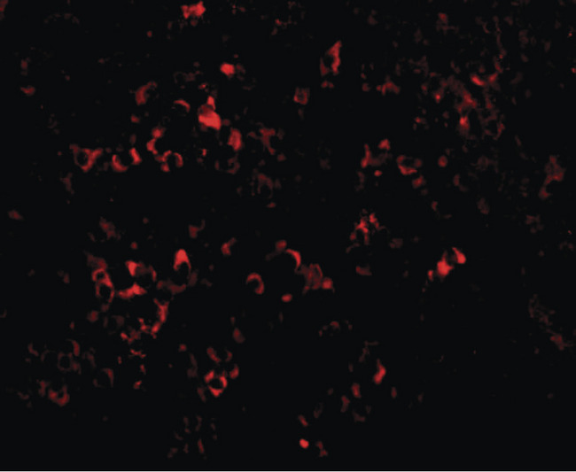 PAK2 Antibody - Immunofluorescence of PAK2 in mouse spleen tissue with PAK2 antibody at 20 ug/ml.