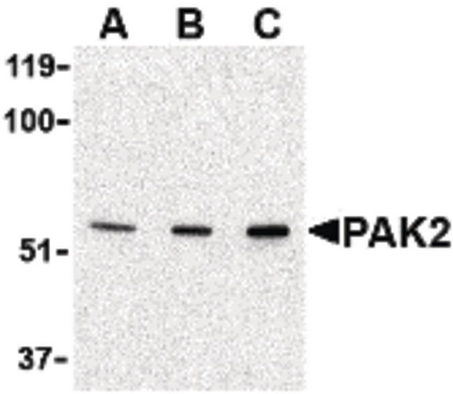 PAK2 Antibody - Western blot of PAK2 in Jurkat lysate with PAK2 antibody at (A) 0.5, (B) 1 and (C) 2 ug/ml.