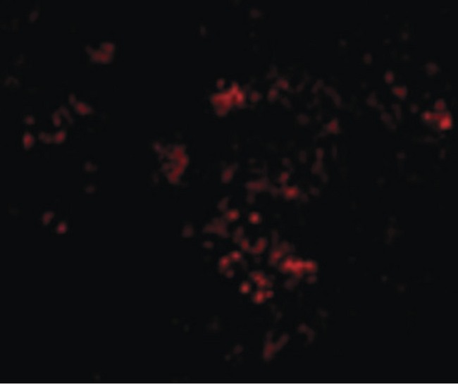 PAK2 Antibody - Immunofluorescence of PAK2 in Mouse Spleen cells with PAK2 antibody at 20 ug/ml.