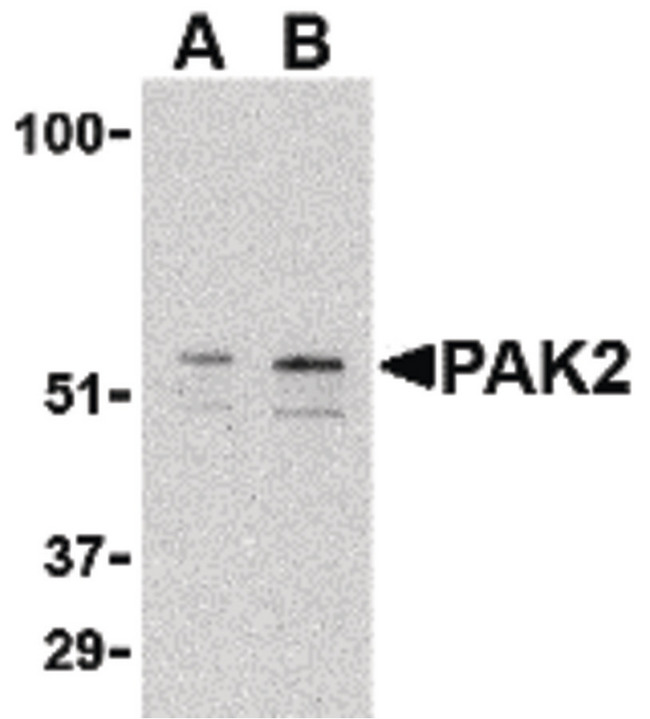 PAK2 Antibody - Western blot of PAK2 in Jurkat lysate with PAK2 antibody at (A) 0.5 and (B) 1 ug/ml.